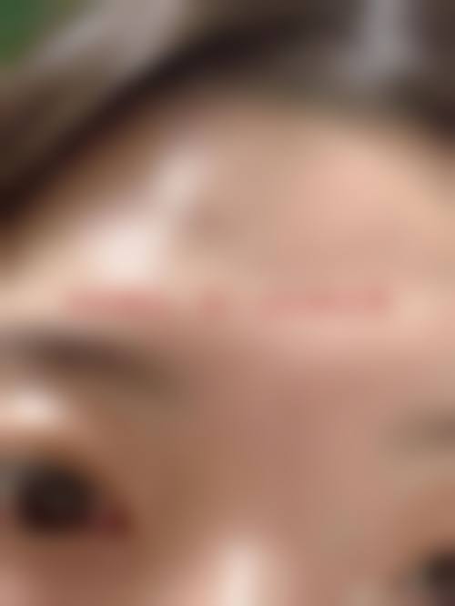 四、北京爱慕医疗美容医院特色项目