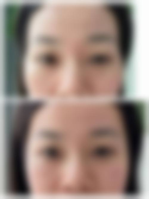 五、邯郸市李亭医疗美容诊所价格表