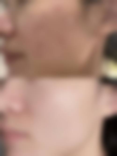 五、赵紫电怎么预约？