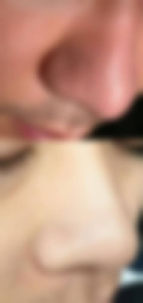 八、邯郸市李亭医疗美容诊所真实的患者评价