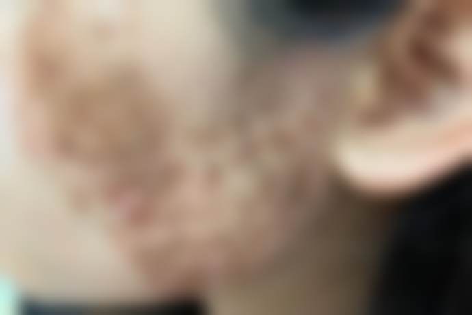 六、李延兵真实的患者评价