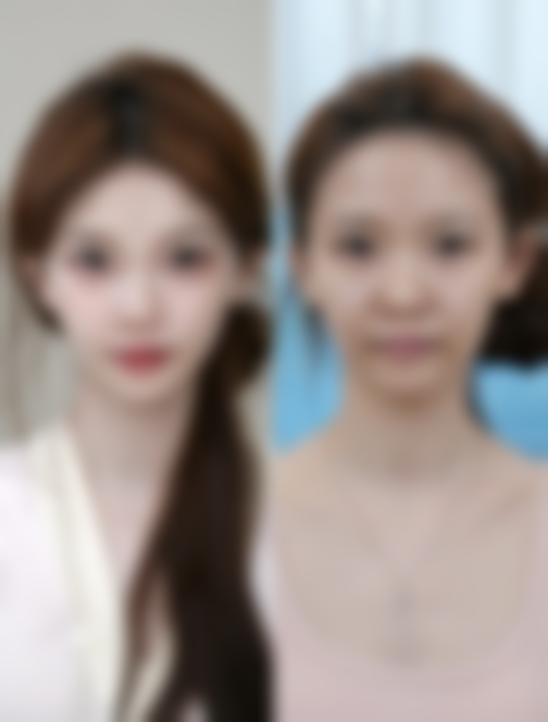 一、哪有超声法去眼袋之常见机构