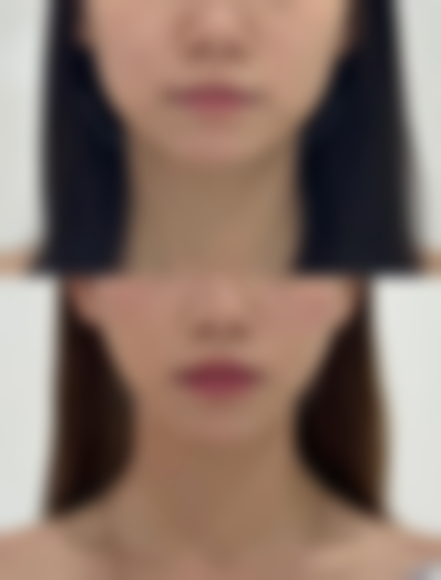 二、马鞍山福华医疗美容诊所怎么样？