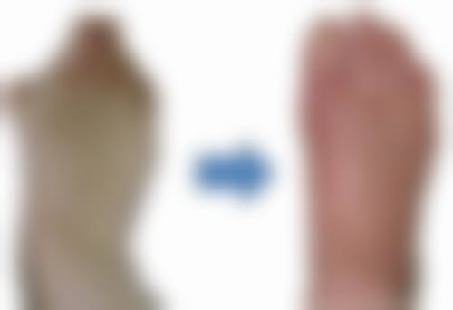 一、打了瘦脸针后吃瓜子的总体原则