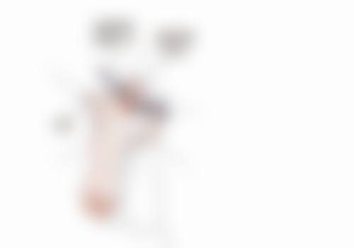 一、术后早期护理（0 - 3个月）