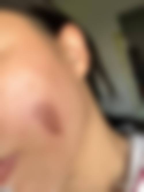 八、柳州罗池医院真实的患者评价