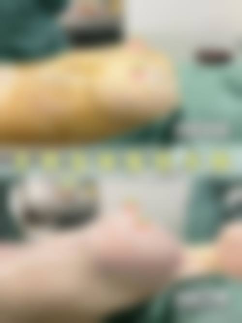 八、武汉雅美荟医疗美容门诊部真实的患者评价