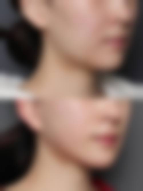 七、彭州熹亚水样女人整形医院预约方式