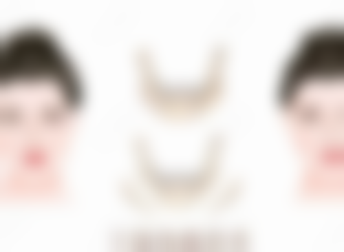 一、埋线双眼皮的线可以吸收吗