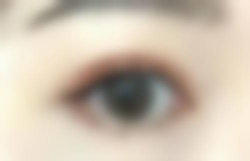 八、乌鲁木齐阳光天使整形医院预约方式