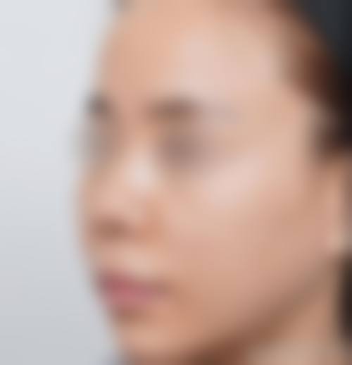 七、襄垣县创颜美整形医院预约方式