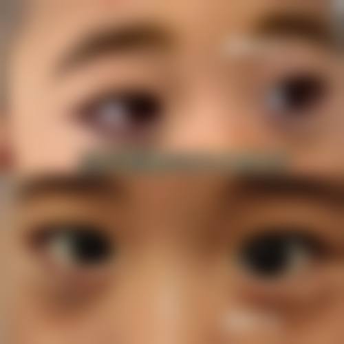 三、长春市韵美医疗美容诊疗项目有哪些？