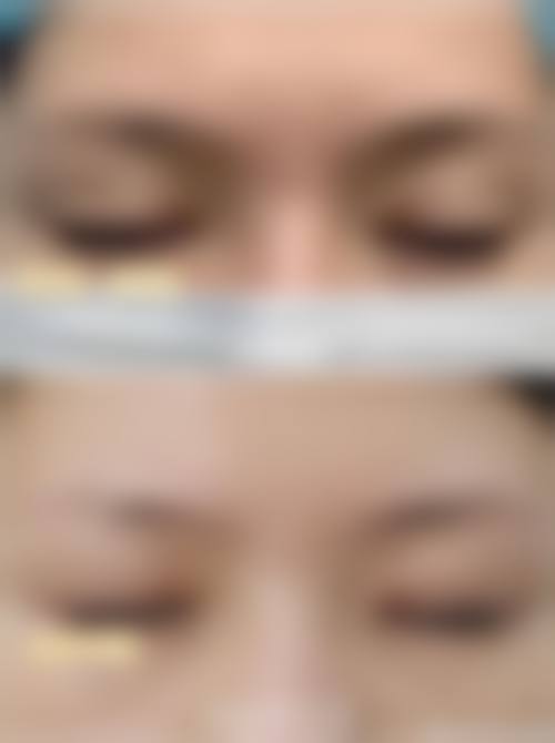 九、九江柔本丽格医疗美容门诊部真实的患者评价