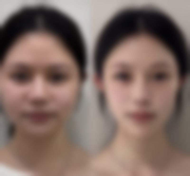 五、选择合适的手术方式和医生