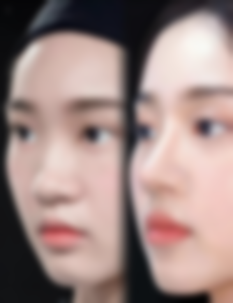 九、乌鲁木齐阳光天使整形医院真实的患者评价