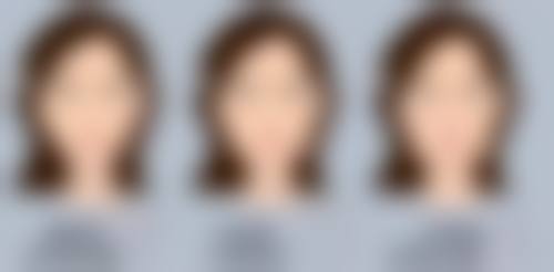 二、去眼袋什么方法较好之家庭护理方法