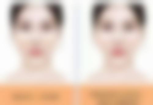 五、割了双眼皮比以前难看的其他应对方法