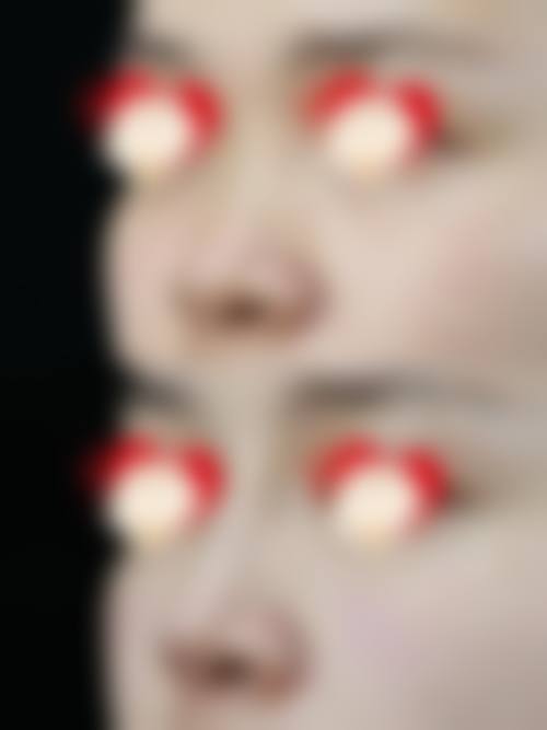 九、韩国Brandnew整形医院真实的患者评价