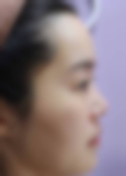 三、韩国Brandnew整形医院诊疗项目有哪些?