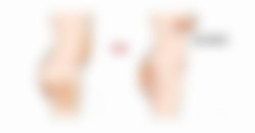 二、疤痕增生的症状有哪些