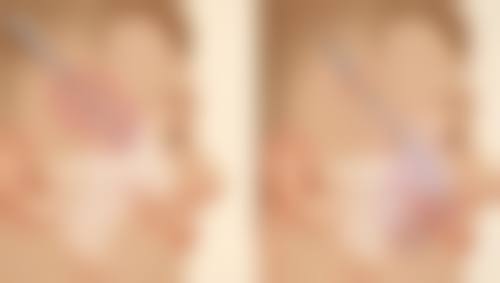 女性出现眼袋是怎么回事？遗传、衰老、生活习惯等因素大揭秘！ 