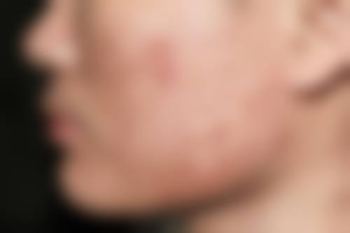 三、赵菊花技术优势