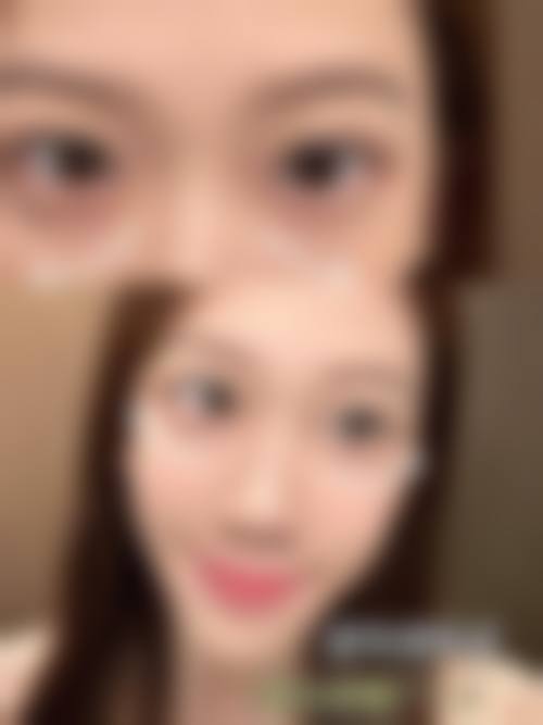 四、首尔slim外科特色项目