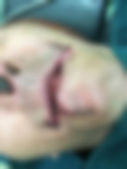 七、首尔slim外科预约方式