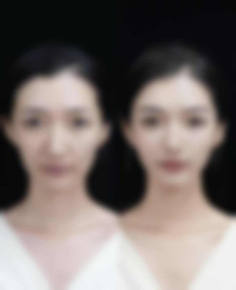 七、治疗注意事项