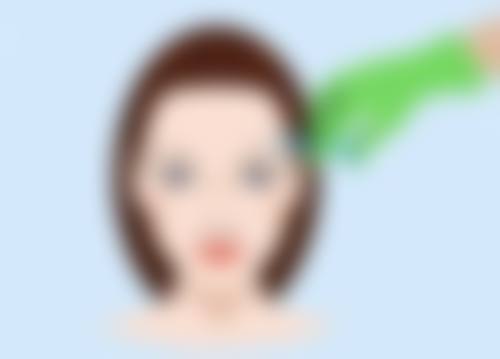 一、阴道紧缩术成效持续时间