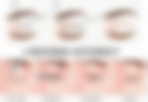 四、割双眼皮术前生活习惯调整