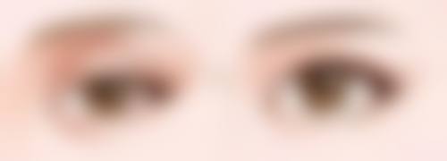 七、割双眼皮术前其他注意事项