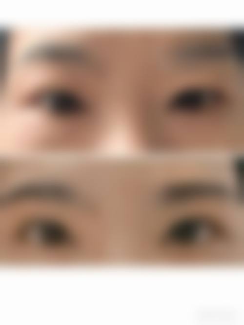 二、六盘水首钢水钢医院烧伤整形科怎么样?