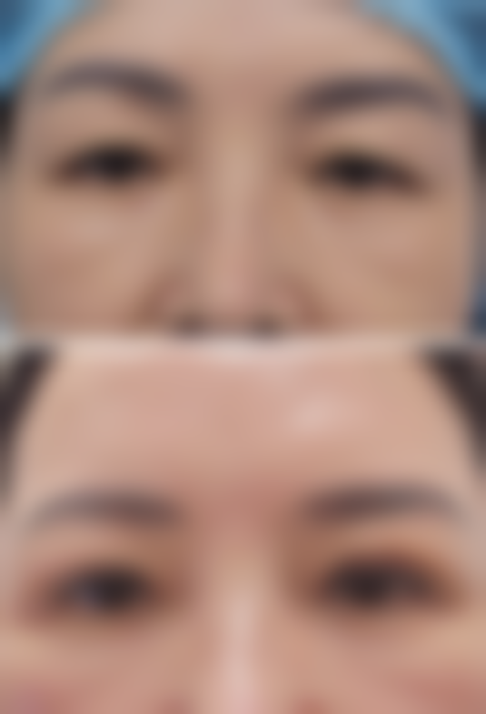 六、选择杭州悦可医疗美容诊所及熊员平医生的建议