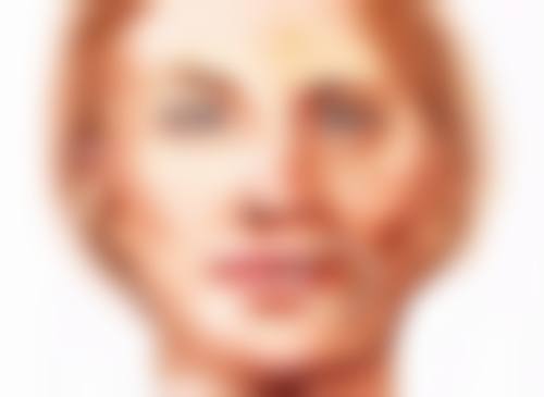 三、不同下垂类型适合的手术方式及成效