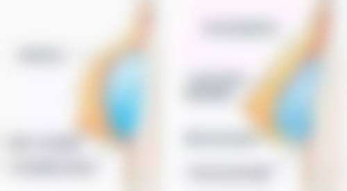 三、深蓝射频除皱治疗频率和疗程