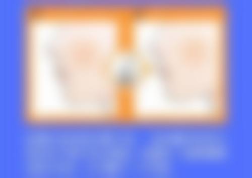 四、全身抽脂的注意事项