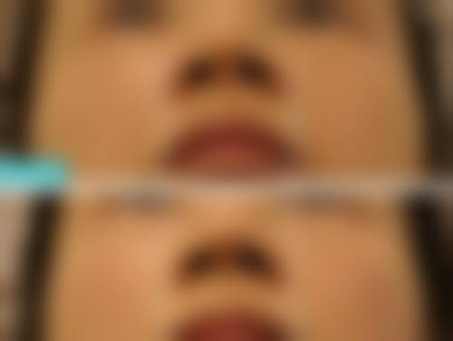 八、威海艾臻仁医疗美容门诊部真实的患者评价