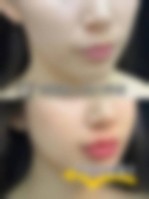 四、深圳市福田人民医院整形美容科特色项目