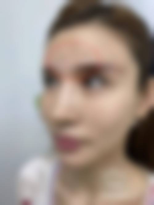 七、威海艾臻仁医疗美容门诊部预约方式