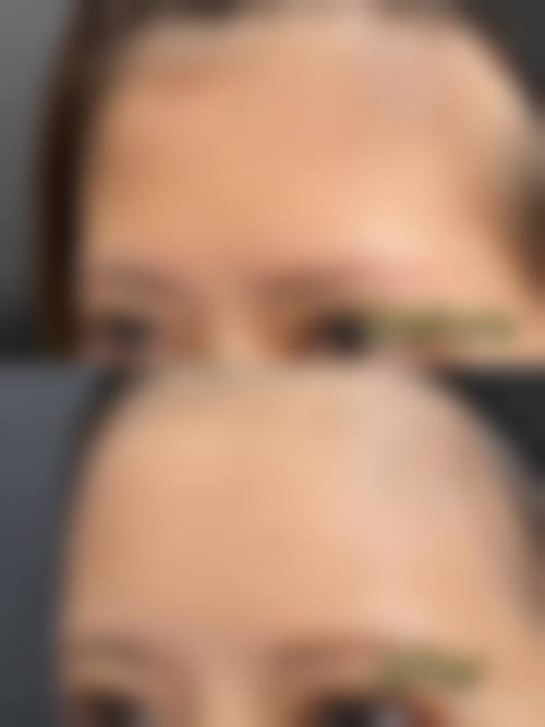 四、威海艾臻仁医疗美容门诊部特色项目