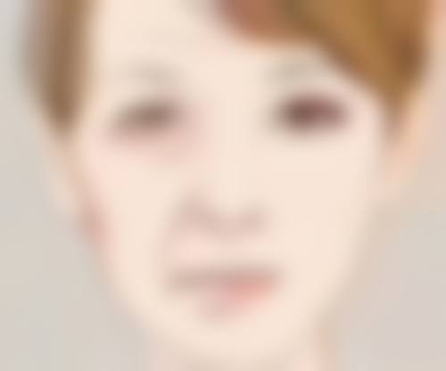 隆胸都是用硅胶吗？了解常见隆胸材料特点及对比，附图片解析助你选方案 