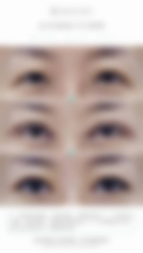 三、深圳康盈整形门诊部诊疗项目有哪些？