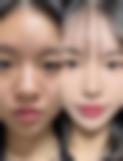 四、江苏省人民医院整形烧伤科特色项目