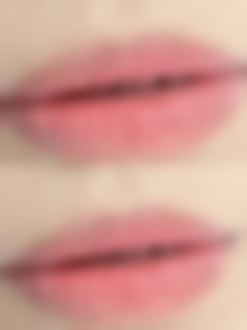 四、深圳康盈整形门诊部特色项目