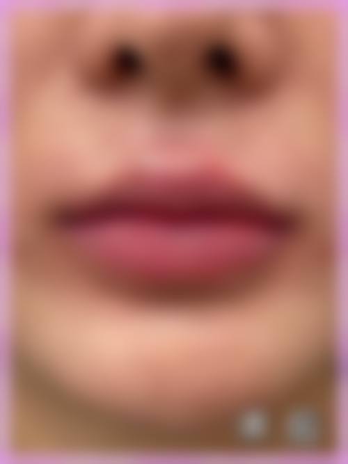 二、深圳康盈整形门诊部怎么样？