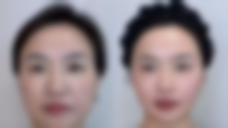 三、轻医美治疗方案