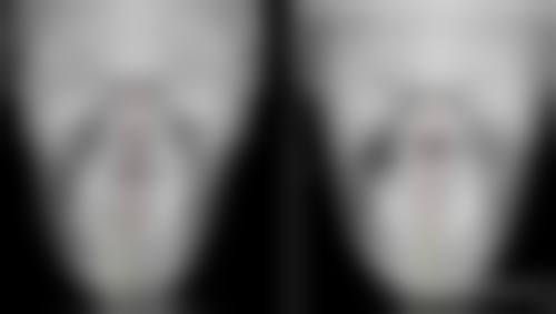 三、术前准备与注意事项