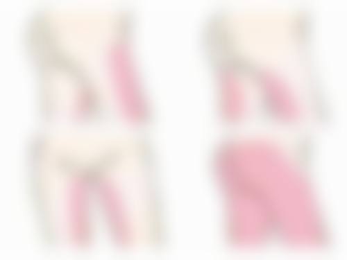 五、内切眼袋术后异常情况处理及心态调整