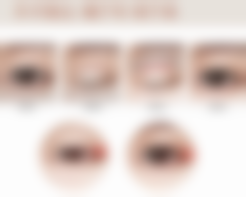 四、影响内切眼袋修复的因素大揭秘